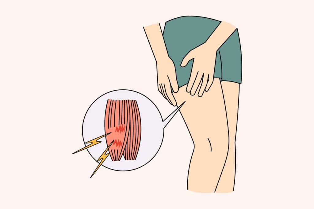 What is delayed onset muscle soreness?